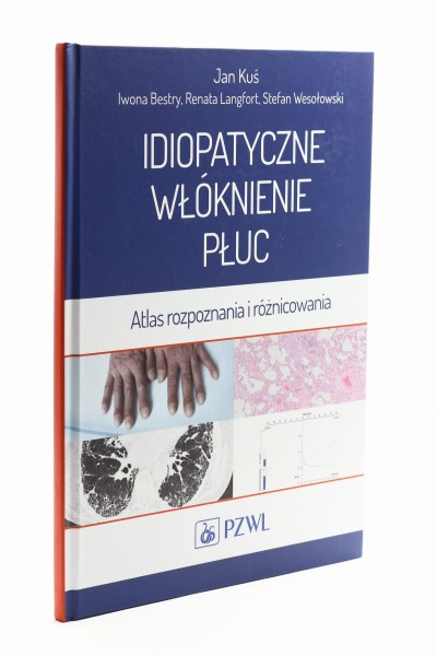 Idiopatyczne włóknienie płuc Kuś