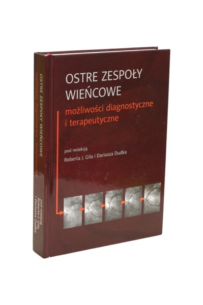 Ostre zespoły wieńcowe możliwości diagnostyczne i terapeutyczne Gil