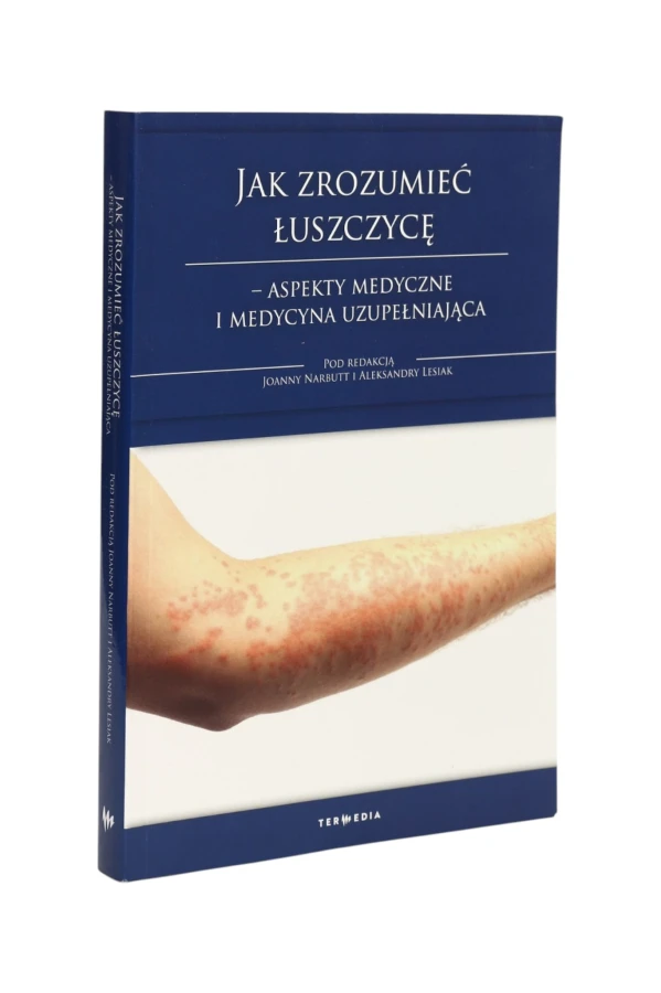 Jak zrozumieć łuszczycę Narbutt Nowa