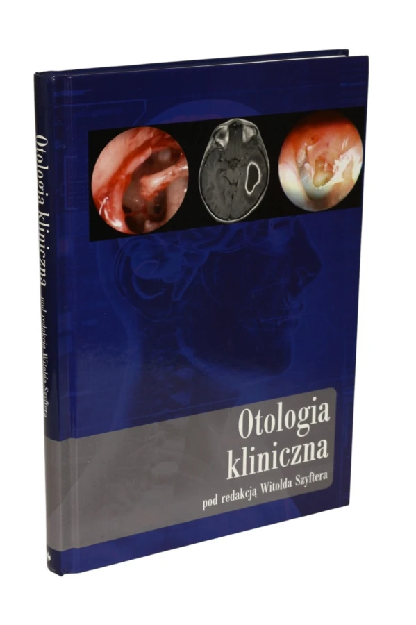 Otologia kliniczna  Szyftera